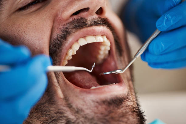 Best Oral Cancer Screening  in New London, TX