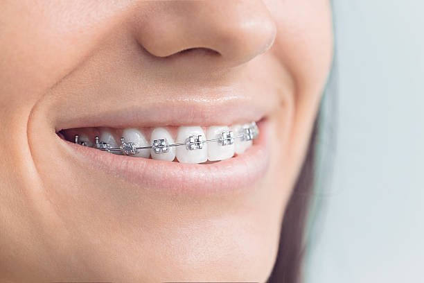 Best Root Canal Treatment  in New London, TX